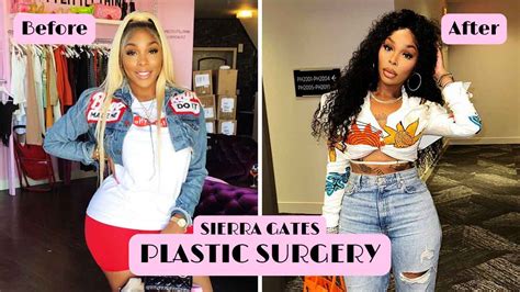 surgery sierra from love and hip hop|Reality TV star Sierra Gates opens up about health scare after。